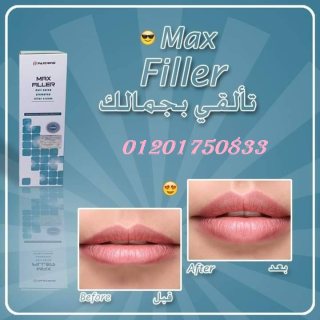 يتخلص من تجاعيد البشره ويعمل علي شدهاmax filler  7