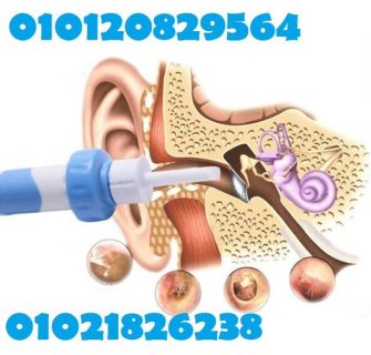 جهاز تنضيف الاذن بواسطة الشفط