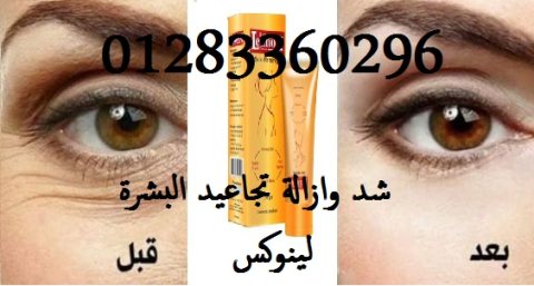 #كريم_لينوكس skin firming #لشد_تجاعيد_البشرة